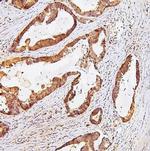 TDRD3 Antibody in Immunohistochemistry (Paraffin) (IHC (P))