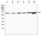 TDRD3 Antibody in Western Blot (WB)