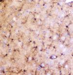 LRTOMT Antibody in Immunohistochemistry (Paraffin) (IHC (P))