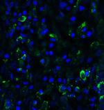 SMURF2 Antibody in Immunohistochemistry (Paraffin) (IHC (P))