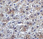 SMURF2 Antibody in Immunohistochemistry (Paraffin) (IHC (P))