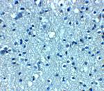 VTI1A Antibody in Immunohistochemistry (Paraffin) (IHC (P))