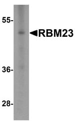 RBM23 Antibody in Western Blot (WB)