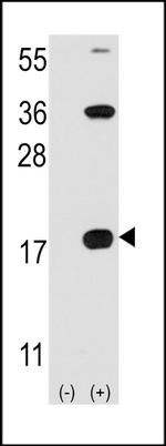 CD3z Antibody in Western Blot (WB)