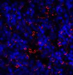 TIM-3 Antibody in Immunohistochemistry (Paraffin) (IHC (P))