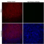 TIM-3 Antibody in Immunohistochemistry (Paraffin) (IHC (P))