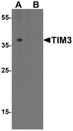 TIM-3 Antibody in Western Blot (WB)