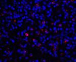 B7-H3 (CD276) Antibody in Immunohistochemistry (Paraffin) (IHC (P))