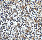 B7-H3 (CD276) Antibody in Immunohistochemistry (Paraffin) (IHC (P))