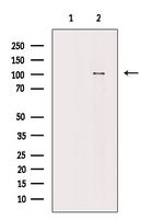 Phospho-alpha Actinin 1/2/3/4 (Ser159) Antibody in Western Blot (WB)