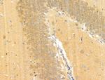 Phospho-EPRS (Ser886) Antibody in Immunohistochemistry (Paraffin) (IHC (P))