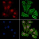 Phospho-Progesterone Receptor (Ser190) Antibody in Immunocytochemistry (ICC/IF)