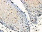 Phospho-Progesterone Receptor (Ser190) Antibody in Immunohistochemistry (Paraffin) (IHC (P))