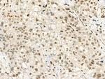 Phospho-Progesterone Receptor (Ser190) Antibody in Immunohistochemistry (Paraffin) (IHC (P))