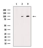 Phospho-Progesterone Receptor (Ser190) Antibody in Western Blot (WB)