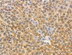 Phospho-PYGL (Ser15) Antibody in Immunohistochemistry (Paraffin) (IHC (P))