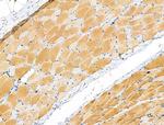 Phospho-PYGL (Ser15) Antibody in Immunohistochemistry (Paraffin) (IHC (P))