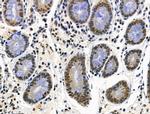 Phospho-RSK Pan (Ser221, Ser227, Ser218, Ser232) Antibody in Immunohistochemistry (Paraffin) (IHC (P))