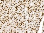 Phospho-RSK Pan (Ser221, Ser227, Ser218, Ser232) Antibody in Immunohistochemistry (Paraffin) (IHC (P))