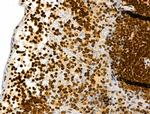 Phospho-RSK Pan (Ser221, Ser227, Ser218, Ser232) Antibody in Immunohistochemistry (Paraffin) (IHC (P))