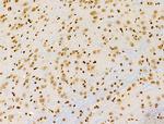 Phospho-RSK Pan (Ser221, Ser227, Ser218, Ser232) Antibody in Immunohistochemistry (Paraffin) (IHC (P))