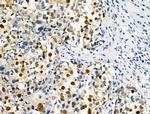 Phospho-SAMHD1 (Thr592) Antibody in Immunohistochemistry (Paraffin) (IHC (P))