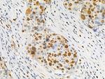 Phospho-SAMHD1 (Thr592) Antibody in Immunohistochemistry (Paraffin) (IHC (P))