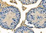 GPR64 Antibody in Immunohistochemistry (Paraffin) (IHC (P))