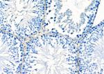 GPR64 Antibody in Immunohistochemistry (Paraffin) (IHC (P))