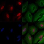 MSH3 Antibody in Immunocytochemistry (ICC/IF)