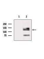 MSH3 Antibody in Western Blot (WB)