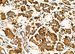 ACVR2A Antibody in Immunohistochemistry (Paraffin) (IHC (P))