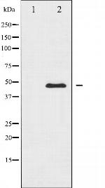 CaMKII alpha/delta Antibody in Western Blot (WB)