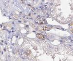 CD47 Antibody in Immunohistochemistry (Paraffin) (IHC (P))