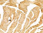 CLPB Antibody in Immunohistochemistry (Paraffin) (IHC (P))