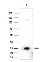 Cofilin 1/2 Antibody in Western Blot (WB)