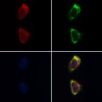 Cofilin 1/2 Antibody in Immunocytochemistry (ICC/IF)