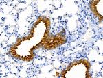 Cofilin 1/2 Antibody in Immunohistochemistry (Paraffin) (IHC (P))