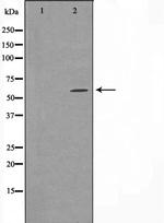 CYP24A1 Antibody in Western Blot (WB)