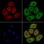 DERL2 Antibody in Immunocytochemistry (ICC/IF)