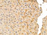 DERL2 Antibody in Immunohistochemistry (Paraffin) (IHC (P))