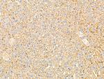 DERL2 Antibody in Immunohistochemistry (Paraffin) (IHC (P))