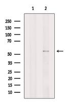 DGAT1 Antibody in Western Blot (WB)