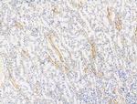 DNAH1 Antibody in Immunohistochemistry (Paraffin) (IHC (P))