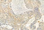 eIF4A3 Antibody in Immunohistochemistry (Paraffin) (IHC (P))