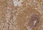 EphA6 Antibody in Immunohistochemistry (Paraffin) (IHC (P))