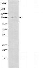 EphA7 Antibody in Western Blot (WB)