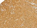 Myosin Heavy Chain Antibody in Immunohistochemistry (Paraffin) (IHC (P))