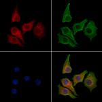 FUCA1 Antibody in Immunocytochemistry (ICC/IF)