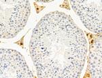 FUCA1 Antibody in Immunohistochemistry (Paraffin) (IHC (P))